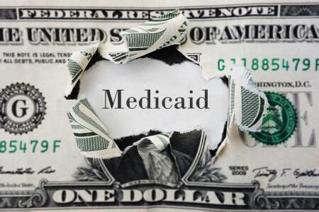 Does Medicaid Cover Adult Dental Implants in Your State